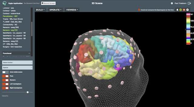 Screenshot of Hygie software