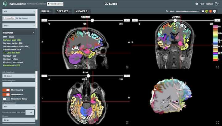 Screenshot of Hygie software