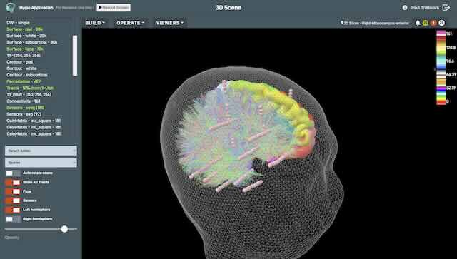 Screenshot of Hygie software